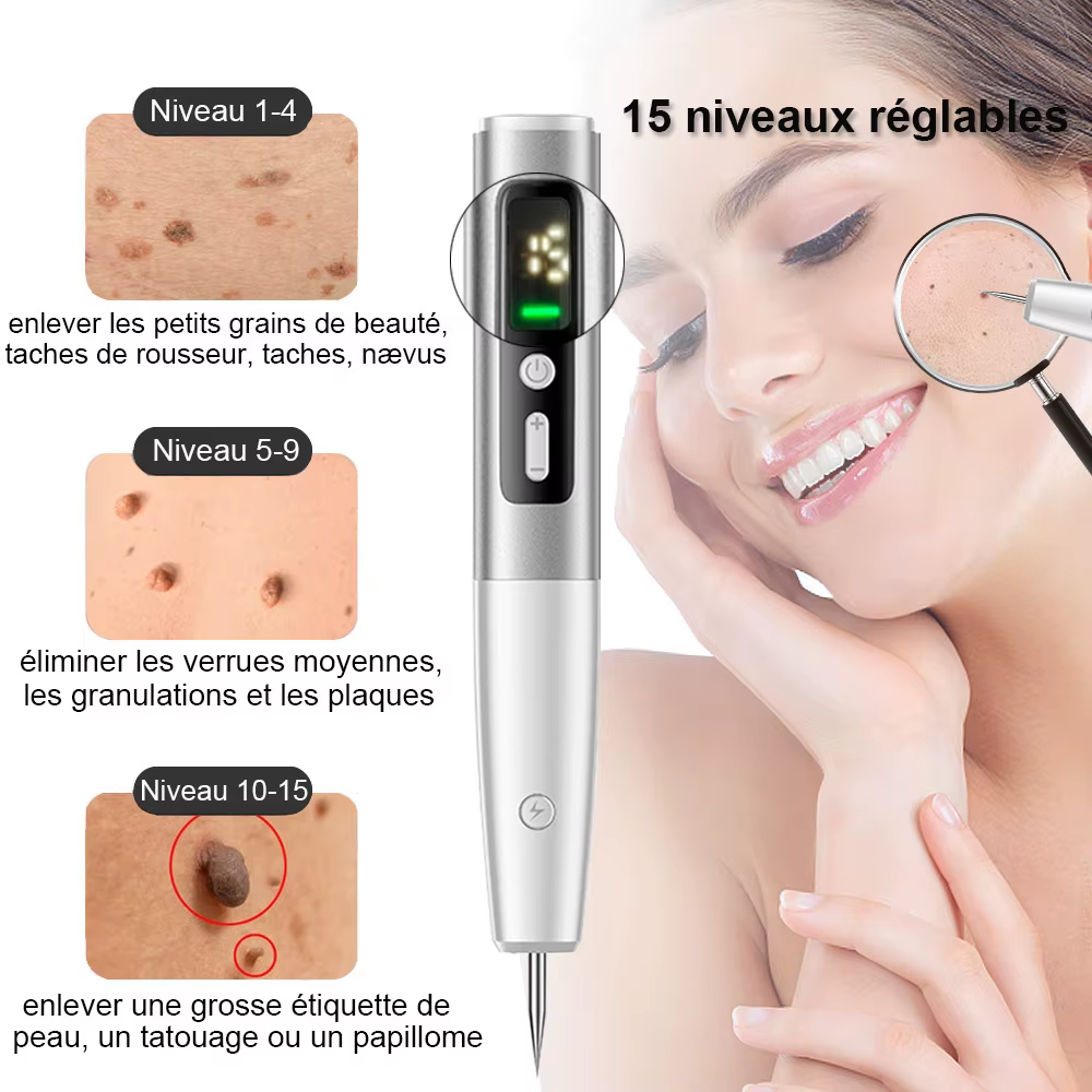 Appareil d'enlèvement des taches cutanées au plasma laser